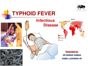 typhoid-fever-ppt-1-638